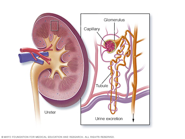 Viêm thận lupus: triệu chứng và điều trị